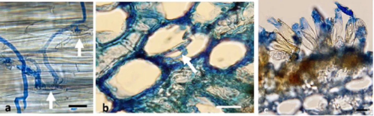 Gambar 4. Infeksi Atelocauda digitata pada daun Acacia auriculiformis. (a) Penetrasi hifa via lubang stomata (tanda panah) dua hari setelah inokulasi, (b) hifa intraseluler (tanda panah) lima hari setelah inokulasi, dan (c) teliospora pada permukaan daun, 