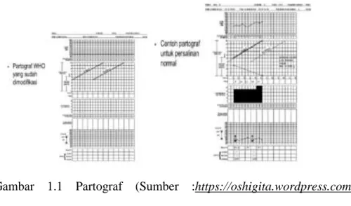 Gambar  1.1  Partograf  (Sumber  :https://oshigita.wordpress.com  /2014/01/10/temuan-keadaan-normal-dan-abnormal-dari-partograf/)  1)  Pengertian 