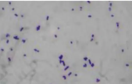 Gambar 2.4 Bacillus licheniformis  (Purwani  dkk., 2009) 