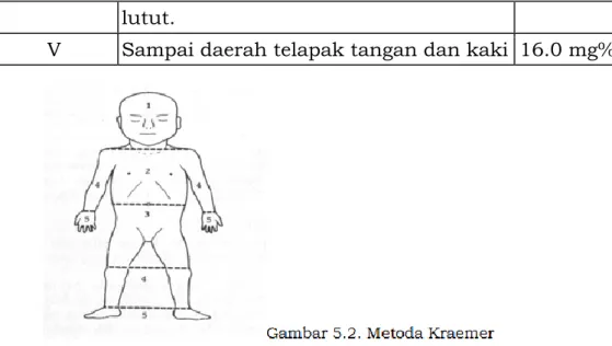 Gambar 5.2. Metoda Kraemer  