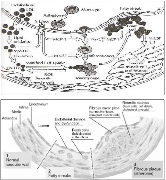 Gambar 2.1 : Proses Aterosklerosis 