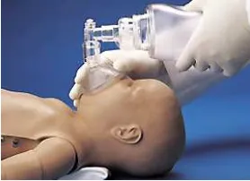 Figure 1: Example of immediate manual resuscitation recommended for a severely asphyxiatinginfant