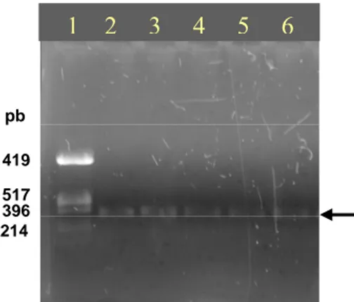 Gambar IV.11   Elektroforegram fragmen gen 16S rRNA hasil amplifikasi sampel  kultivasi Kawah Hujan A 