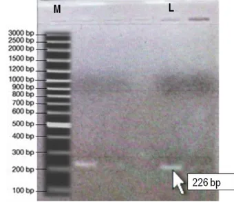 Gambar 1. Profil elektroforesis hasil PCR Gen  Glutation S Transferase (Sj26GST)  sampel cacing S