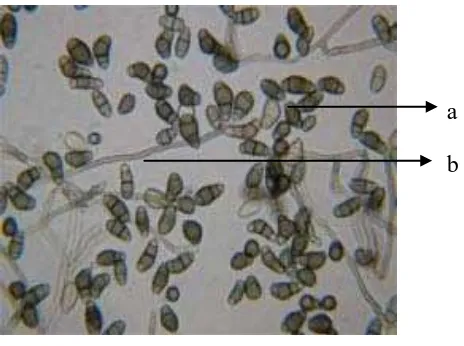 Gambar 5.  Curvularia sp. Koloni berumur 14 hari pada media PDA (A) dan bentuk mikroskopik (B), (a) Konidia, (b) Konidiofor 