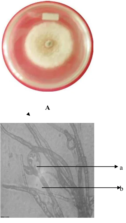 Gambar 6. Phytohpthora sp. Koloni berumur 14 hari pada media PDA (A) dan bentuk miskoskopik (B), (a) Sporangium,  (b) Sporangiofor 