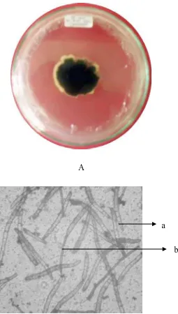 Gambar 7. Cercospora sp.Koloni berumur 14 hari pada media PDA (A) dan bentuk mikroskopik (B), (a) Konidia (b) Konidiofor 