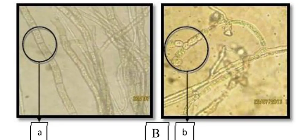 Gambar 3. Karakteristik Makroskopis dan Mikroskopis jamur Cercospora sp.  Keterangan: 