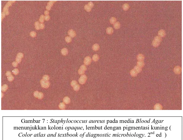 Gambar 7 : Staphylococcus aureusmenunjukkan koloni  pada media Blood Agar opaque, lembut dengan pigmentasi kuning ( 
