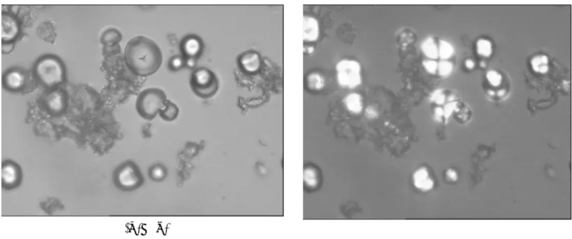 Gambar 4: Molekul bahan cetak alginat + pati ubi kayu dengan mikroskop cahaya biasa (a) dan  molekul bahan cetak alginat + pati ubi kayu  dengan mikroskop cahaya terpolarisasi (b)