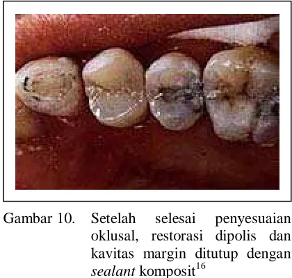Gambar 10. Setelah     