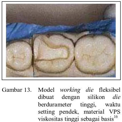 Gambar 12. Pencetakan preparasi inlay dengan vinil  polisiloksan yang sebelumnya telah diolesi  