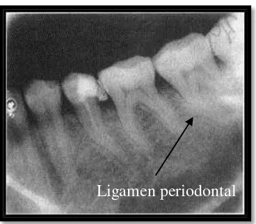 Gambar 2. Ligamen periodontal10 
