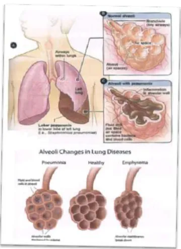 Gambar 2.1 SistemPernafasan  (Nurarif &amp; Kusuma, 2013)  Sistem Pernafasan 