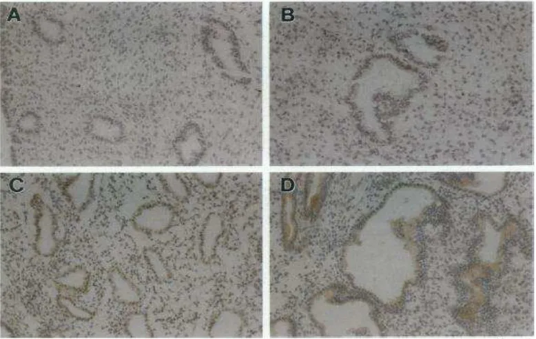 Gambar 9. Histopatologi Endometeriosis .6 