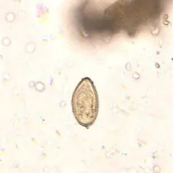 Gambar 2.8 Opistorchis felineus (Sumber : CDC, 2012) 