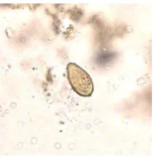 Gambar 2.9 Daur Hidup Opistorchis spp (Sumber : CDC, 2012) 