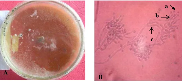 Gambar 7. Trichoderma sp.1 koloni berumur 14 hari pada media PDA (A) dan  bentuk makroskopis (B); Konidia (a), Fialid (b), dan Konidiofor (c) 
