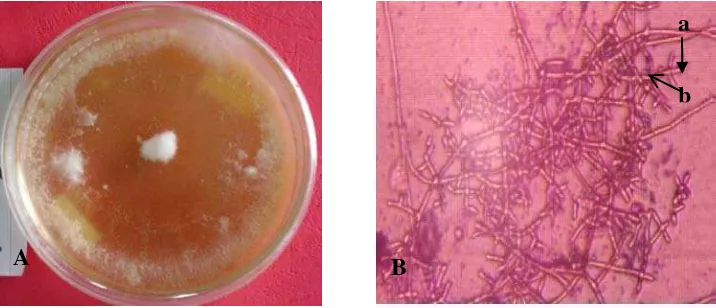 Gambar 8. Trichoderma sp.2 koloni berumur 14 hari pada media PDA (A) dan  bentuk mikroskopis (B); fialid (a) dan konidiofor (b) 