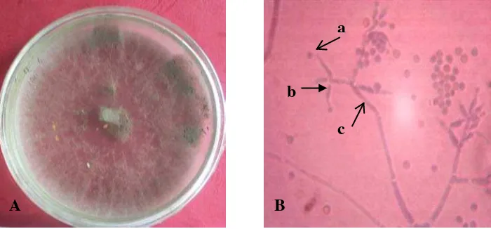 Gambar 9. Trichoderma sp. 3 koloni berumur 14 hari pada media PDA (A) dan  bentuk mikroskopis (B); konidia (a), fialid (b) dan konidiofor (c) 