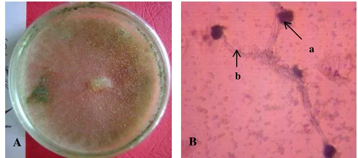 Gambar 10. Mucor sp koloni berumur 14 hari pada media PDA (A) dan bentuk    mikroskopis (B); sporangium (a) dan sporangiofor (b) 
