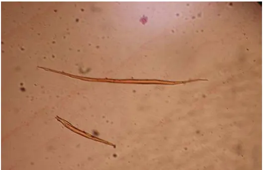 Gambar 8. Serat Mindi (M. azedarach L.)    Perbesaran 100x 