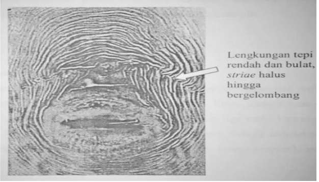 Gambar 4. Ciri khusus pola perineal Meloidogyne javanica (Sumber : Eisenback, 2003) 