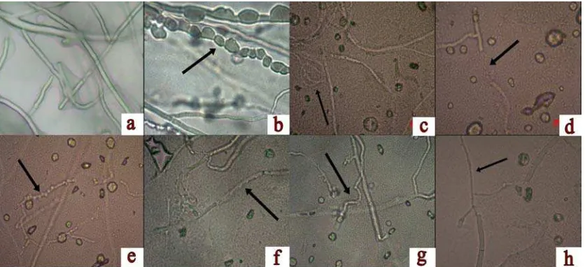 Gambar 4.3.1 Bentuk  hifa  Sclerotium rolfsii  setelah  uji antagonis dengan bakteri kitinolitik: (a) hifa normal, (b) hifa membengkak dan memendek oleh BK13, (c) hifa menggulung  oleh BK15, (d) hifa putus oleh BK15, (e) hifa kerdil oleh BK15, (f) hifa lisis oleh BK15, (g) hifa bengkok oleh BK 15, dan (h) hifa mengecil oleh BK15 (h) (perbesaran 40 x 10) 
