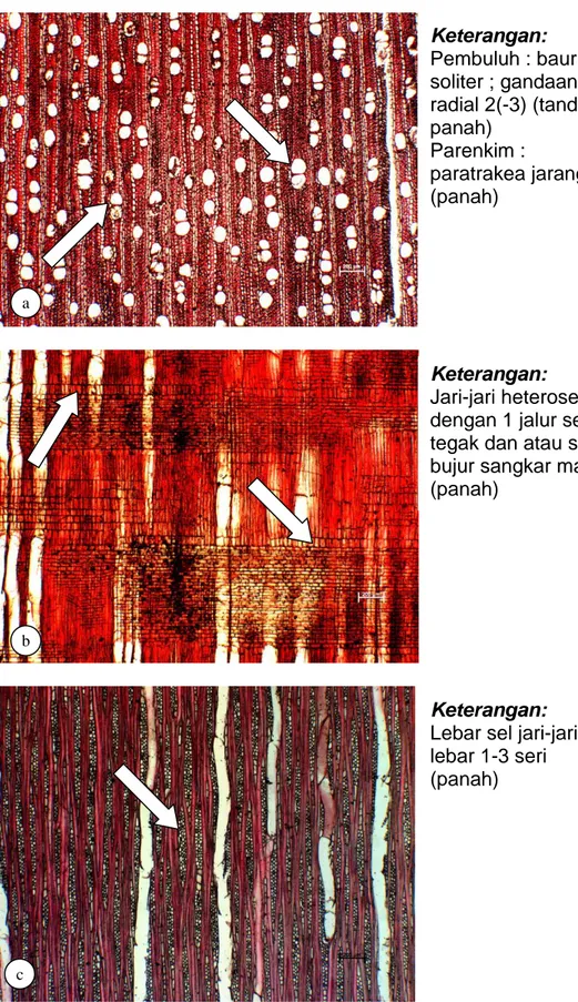 Gambar  7.  Penampang  mikroskopis  kayu  Mastixiodendron  pachyclados   pada  bidang  transversal  (a),  radial  (b)  dan  tangensial  (c),  (perbesaran 25 x)    Keterangan:     Pembuluh : baur;  soliter ; gandaan  radial 2(-3) (tanda panah) Parenkim :  p