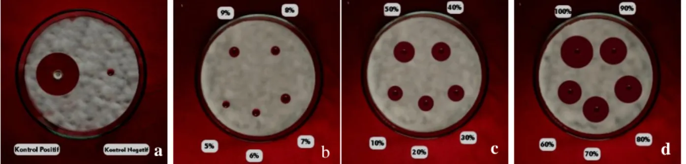Gambar  9. Uji  konsentrasi  filtrat  N-butanol  Streptomyces  sp.5 dengan  C. acutatum  a (kontrol  positif dan kontrol  negatif), b (perlakuan 5% - 9%), c (perlakuan 10% -50%), d (perlakuan 60-100%)
