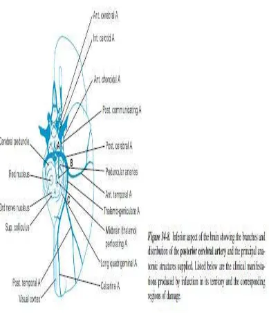 Gambar 4: Territori posterior Cerebral Artery 