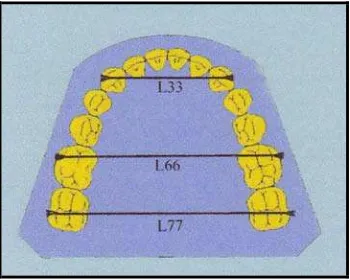 Gambar 7. Pengukuran lengkung gigi dalam arah transversal2 