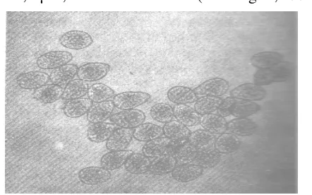 Gambar 1. Urediospora Phakopsora pachyrhizi Syd. penyebab penyakit karat kedelai 300 x(dalam Anon.,1985) 