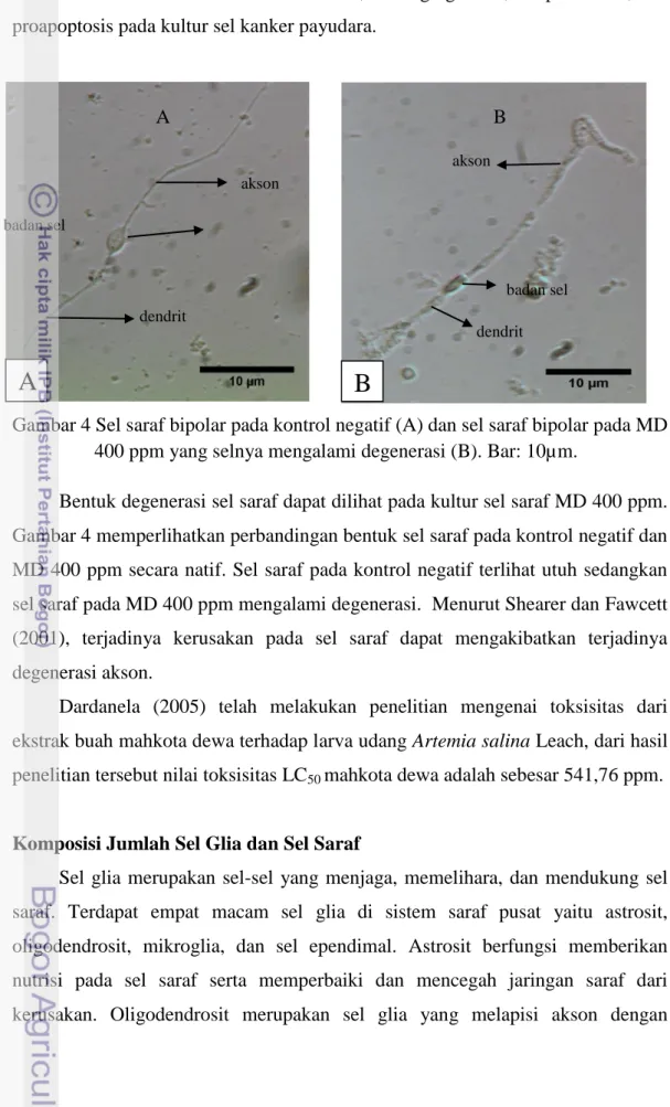 Gambar 4 Sel saraf bipolar pada kontrol negatif (A) dan sel saraf bipolar pada MD  400 ppm yang selnya mengalami degenerasi (B)