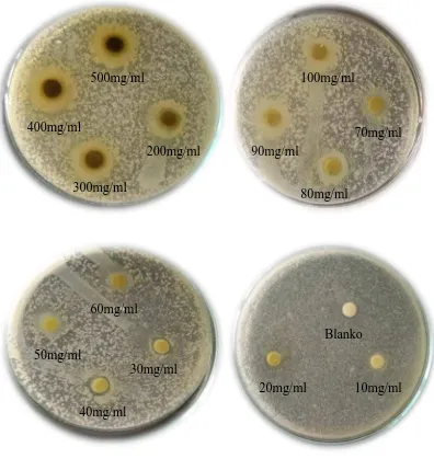 Gambar hasil uji aktivitas antibakteri ekstrak terhadap bakteri Staphylococcus aureus 