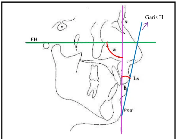 Gambar 12. Garis H, sudut fasial (a), sudut H (b) danbidang Frankfurt horizontal (FH) 