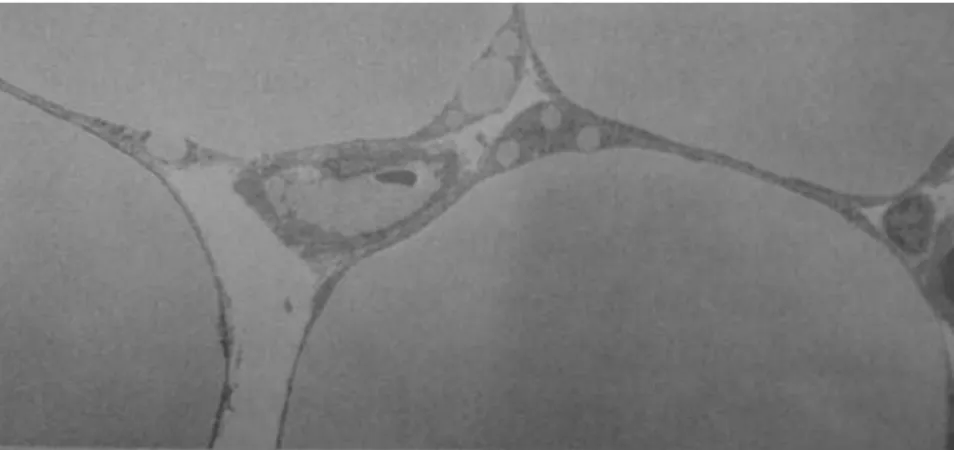 Gambar 2.3 Sel adiposa (Nelson,2008)  2.3  Hambatan Jaringan Tubuh 