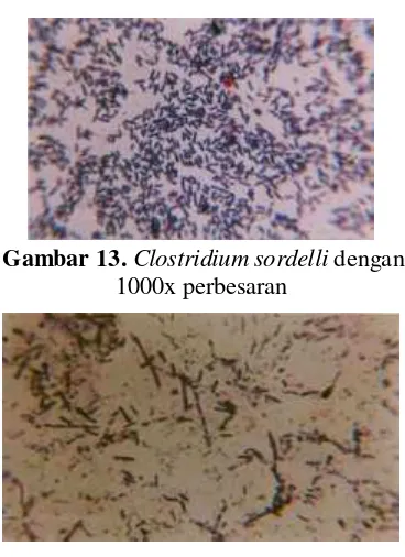 Gambar 15. Citrobacter intermedius dengan 1000x perbesaran 