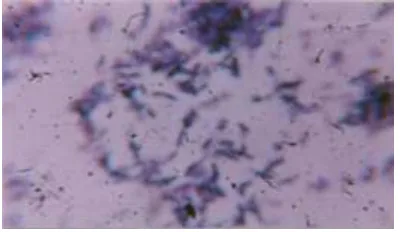 Gambar 17. Bacteroides putredinis dengan 