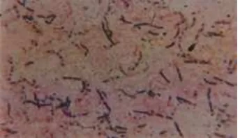 Gambar 12. Bacillus polimyxa dengan 1000x perbesaran 