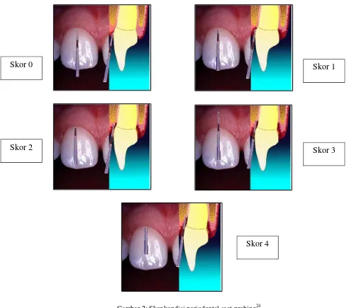 Gambar 2: Skor kondisi periodontal saat probing24 