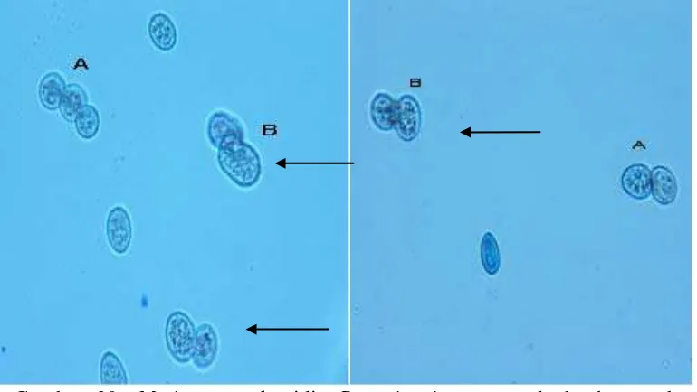 Gambar 39. Mating type konidia Botrytis cinerea  pada buah strawbery                    A: plasmogami (tanda panah)                      B: karyogami (tanda panah) 