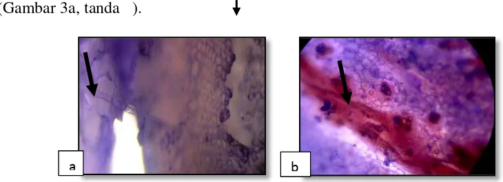 Gambar 2. Gejala serangan  Foc pada permukaan daun  (a), gejala pada pangkal batang (b), dan akar busuk (c)