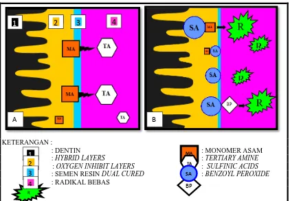 Gambar 6. Skema interaksi antara self cure activator dengan sistem adhesif total etsa dan semen resin di dalam saluran akar, A