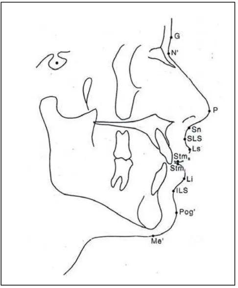 Gambar 6. Titik-titik anatomis jaringan lunak8 