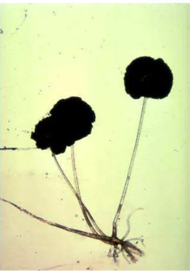 Gambar 2. Struktur mikroskopis R. stolonifer 