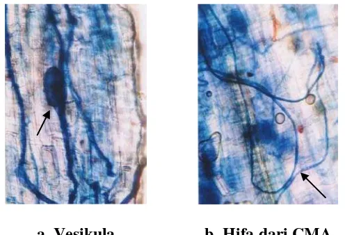 Gambar 4. Tipe-tipe Infeksi CMA pada Akar Tanaman Yang Diobservasi dari Lokasi Penelitian.a)Vesikula pada akar tanaman alang-alang, b) Hifa CMA pada tanaman umbi-umbian