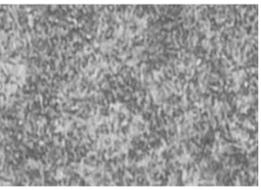 Gambar 5 Struktur Mikro Baja Amutit Diquenching Dengan Dromus 1:30 Temper Suhu 400o C