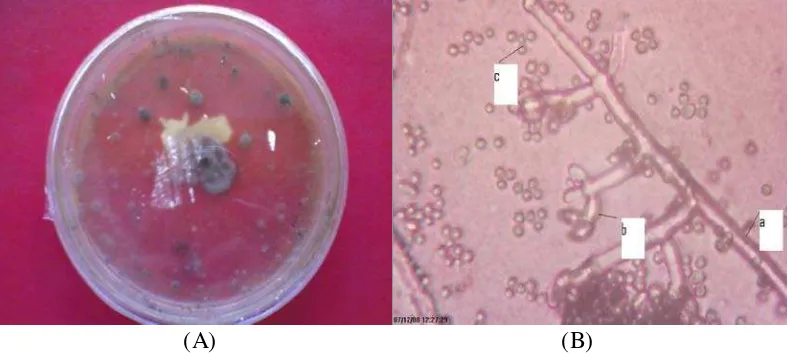 Gambar 5. Trichoderma sp(A) biakan fungi pada media PDA pada hari ke-14,(B) , (a)konidiofor, (b)sel-sel pembentuk konidia dan (c)konidia