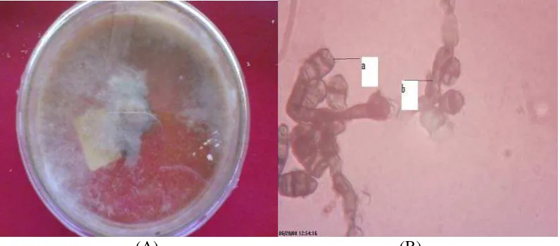 Gambar 6. (A) biakan fungi pada media PDA pada hari ke-14,(B) Alterneria sp, (a)konidia, (b)konidiofor bersepta